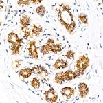 delta Catenin Antibody in Immunohistochemistry (Paraffin) (IHC (P))