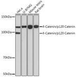 delta Catenin Antibody in Western Blot (WB)