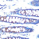 BMP4 Antibody in Immunohistochemistry (Paraffin) (IHC (P))