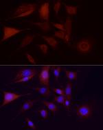 CDK1 Antibody in Immunocytochemistry (ICC/IF)