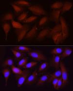 CDK1 Antibody in Immunocytochemistry (ICC/IF)