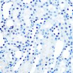 MAD2 Antibody in Immunohistochemistry (Paraffin) (IHC (P))