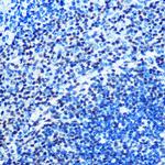 MAD2 Antibody in Immunohistochemistry (Paraffin) (IHC (P))