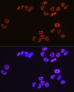 MCM3 Antibody in Immunocytochemistry (ICC/IF)