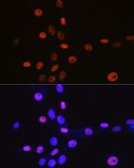 MCM3 Antibody in Immunocytochemistry (ICC/IF)