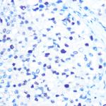 MCM3 Antibody in Immunohistochemistry (Paraffin) (IHC (P))