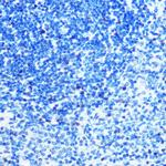 MCM3 Antibody in Immunohistochemistry (Paraffin) (IHC (P))