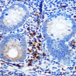 CD41 Antibody in Immunohistochemistry (Paraffin) (IHC (P))