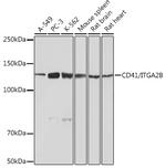 CD41 Antibody in Western Blot (WB)