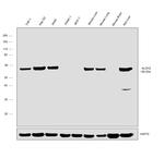 ALDH2 Antibody in Western Blot (WB)