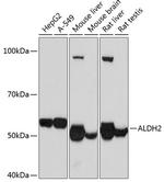 ALDH2 Antibody in Western Blot (WB)