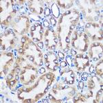 LOX Antibody in Immunohistochemistry (Paraffin) (IHC (P))