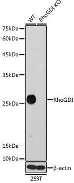 RhoGDI Antibody in Western Blot (WB)