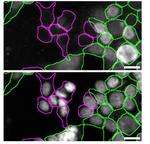 hnRNP A1 Antibody in Immunocytochemistry (ICC/IF)