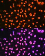 hnRNP A1 Antibody in Immunocytochemistry (ICC/IF)