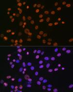 hnRNP A1 Antibody in Immunocytochemistry (ICC/IF)