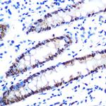 hnRNP A1 Antibody in Immunohistochemistry (Paraffin) (IHC (P))