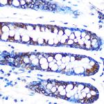 LUM Antibody in Immunohistochemistry (Paraffin) (IHC (P))