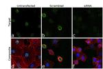 CtBP1 Antibody in Immunocytochemistry (ICC/IF)