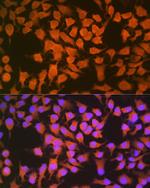 CBS Antibody in Immunocytochemistry (ICC/IF)