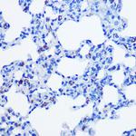 CBS Antibody in Immunohistochemistry (Paraffin) (IHC (P))