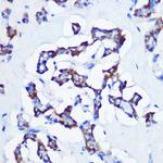 CBS Antibody in Immunohistochemistry (Paraffin) (IHC (P))