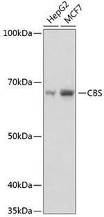 CBS Antibody in Western Blot (WB)