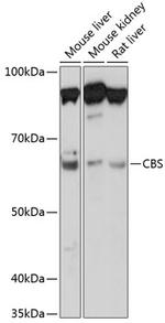 CBS Antibody in Western Blot (WB)