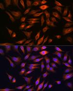 FBP1 Antibody in Immunocytochemistry (ICC/IF)