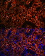 FBP1 Antibody in Immunohistochemistry (Paraffin) (IHC (P))