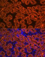 FBP1 Antibody in Immunohistochemistry (Paraffin) (IHC (P))