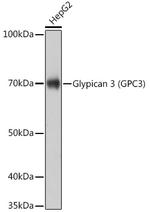 Glypican 3 Antibody in Western Blot (WB)