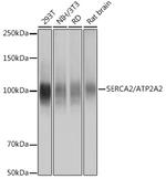 SERCA2 ATPase Antibody in Western Blot (WB)