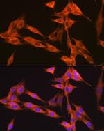 VPS34 Antibody in Immunocytochemistry (ICC/IF)