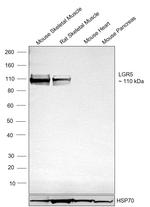 LGR5 Antibody in Western Blot (WB)