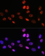 PABPN1 Antibody in Immunocytochemistry (ICC/IF)