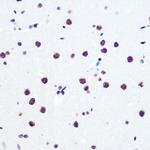 PABPN1 Antibody in Immunohistochemistry (Paraffin) (IHC (P))