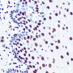 PABPN1 Antibody in Immunohistochemistry (Paraffin) (IHC (P))