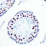 PABPN1 Antibody in Immunohistochemistry (Paraffin) (IHC (P))