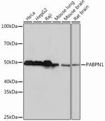 PABPN1 Antibody in Western Blot (WB)