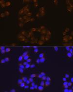 Amyloid Precursor Protein Antibody in Immunocytochemistry (ICC/IF)