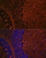 beta-3 Tubulin Antibody in Immunohistochemistry (Paraffin) (IHC (P))