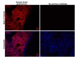 beta-3 Tubulin Antibody in Immunohistochemistry (Paraffin) (IHC (P))