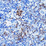 BTK Antibody in Immunohistochemistry (Paraffin) (IHC (P))