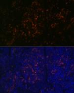 BTK Antibody in Immunohistochemistry (Paraffin) (IHC (P))