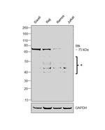 BTK Antibody in Western Blot (WB)