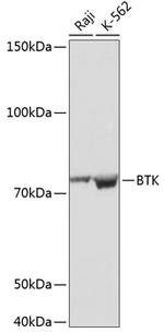 BTK Antibody in Western Blot (WB)