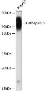 Cathepsin B Antibody in Western Blot (WB)