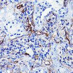 CD105 Antibody in Immunohistochemistry (Paraffin) (IHC (P))