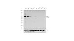 CD105 Antibody